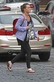 Image result for robert zaruba vitiligo