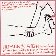 Homans Sign For Thrombosis Dvt Homans Sign Nursing School Studying Nursing School Notes