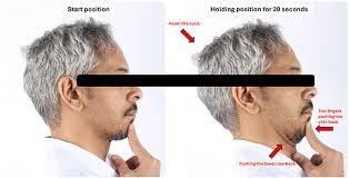 Start and end positions of Chin tuck exercise.