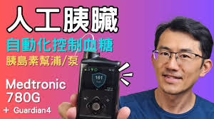 美敦力Medtronic 780G pump Review ...