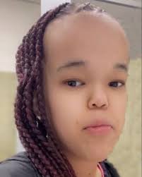 Condolences for the loss of Alexis