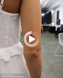Tatouage De Coccinelle A L Arriere Du Bras Droit Tatouage Coccinelle Tatouage Bras