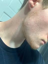 I can't _____ another language. 20 M Will I Ever Be Able To Grow A Beard I Have Very Weak Facial Hair And This Is A Month Without Shaving For Me Wondering If I Should Try Minoxidil