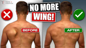 Image result for Winged Scapula