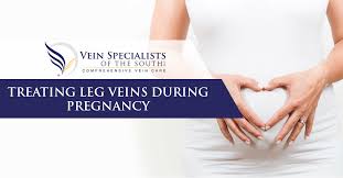 Bulging Painful Leg Veins During Pregnancy Can They Be Treated Vein Specialists Of The South