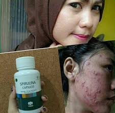 Silah kan di order lagi suplemen obat herbal dari china nya cukup sekali  mengkonsumsi dan sekali order hasil nya permanen ya .. free ongkir untuk  pengiriman ke seluruh indonesia dan free ongkir ,,