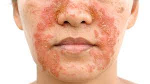 8 Common Types Of Rashes | Everyday Health