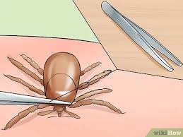 En su mayoría, las garrapatas no transmiten enfermedades. 3 Formas De Tratar Las Picaduras De Garrapata Wikihow