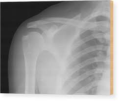Image result for Shoulder Imaging