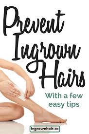 If you're one of those people, you're probably wondering how to get rid of that after applying the warm compress, you can very gently exfoliate the skin trapping the hair. Exfoliate Legs Ingrown Hairs
