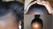 Natural Hair Thinning Edges