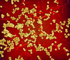 Image result for Lassa Fever