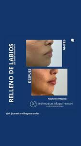 Carmen Puig's Instagram, Twitter & Facebook