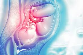 Malformacoes Uterinas Dra Nadia Pavarini
