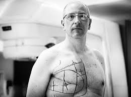 Best breast cancer doctor in delhi used to believe that breast disease in men was more serious than it was in ladies, yet it now appears that it's about the same. How One Man With Breast Cancer Is Helping Researchers Learn