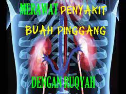 Sakit buah pinggang u0026 30 sebab kenapa anda harus ambil prebiotik fiberup! Ruqyah Penyembuh Sakit Buah Pinggang Heal Kidney Disease Using Powerful Ruqyah Youtube