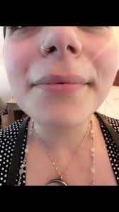 Here you go!! Some of @drbotoxdmd amazing work!! , Here at Robin Erb  Skincare, we strive to make your dreams come true!! All the while creating  a fun, beautiful, and refreshing environment for you to ...