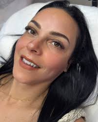 Suas sobrancelhas podem ser recuperadas lindas, naturais e cheias de vida  💕 Técnica de Fios Realistas GoldBrows Strokes Veja o antes no final 👉🏻