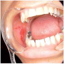 Jordi Journal Of Oral Diagnosis