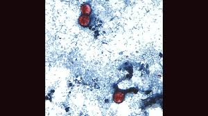 Image result for Cyclospora