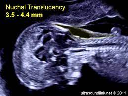Pin On Ultrasound Notes