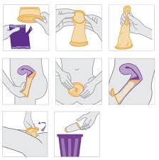 Anal safety tips and condom recommendations