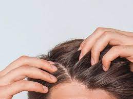 Scabs And Sores On Scalp Treatment Causes And Remedies