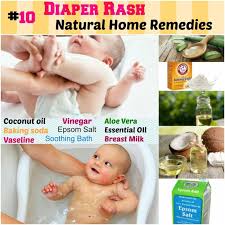 Repeat the same process twice daily to get relief from eczema; Pin On Babiesss