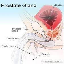 In rare cases, prostate cancer can cause symptoms. Prostate Infection Symptoms Causes Treatment Signs