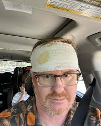 Warning: last slide is graphic.) I grew up surfing. I deeply love it. It's  a core part of how I understand myself. For the last two years I hadn't  gotten out much (