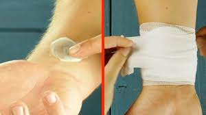 Bruises are extremely common, from those that appear mysteriously to a painful bump. Smear Toothpaste On Your Arm The Next Day You Ll Be Speechless Youtube