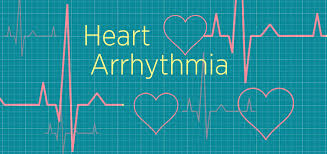 However, these fluctuations are typically short. How An Arrhythmia Irregular Heartbeat Is Treated