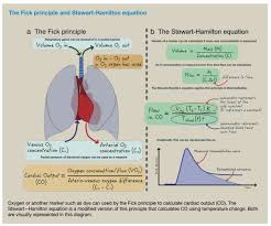 Image result for Intrapleural Anesthesia
