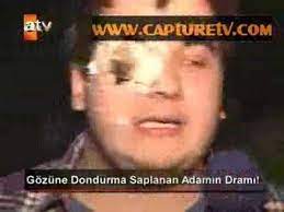 Sahan Gokbakar Gozune Dondurma Saplanan Adam Youtube