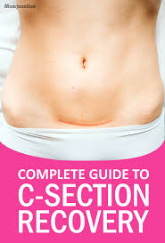 Pin On Women S Health