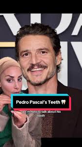 Does Pedro Pascal Have False Teeth