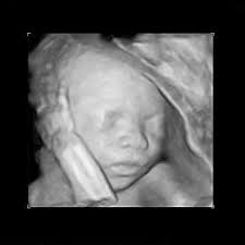 To get a visual idea of what things are looking like inside your belly, check out the illustration below: Week 17 Ultrasound What It Would Look Like Parents