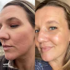 20 top Organic Skincare Therapy ideas in 2024