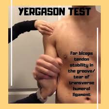 Image result for Yergason Test