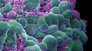 Help diagnose some blood cancers, such as leukemia and lymphoma. Scientists Analyze The Domino Effect Of Breast Cancer Escalation
