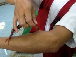 Image result for centipedes bite in africa