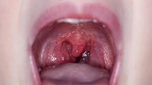 Image result for Adenodolichos