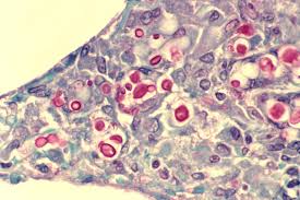 •diffusion and filtration •secretes lubricating substances in serosae. Alveolar Septum Wikipedia