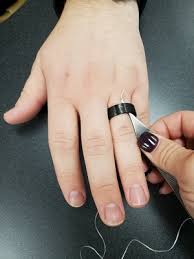 Image result for Ring Removal