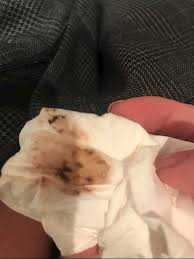 Many amazing changes will be happening in your body over the next 40 weeks. Brown Mucus Discharge Pregnant 6 Weeks