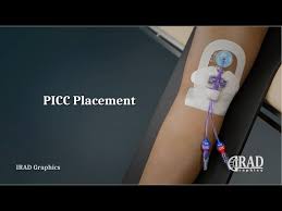 Image result for PICC Line