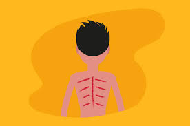 Orang yang mengalami masalah angin dalam badan pasti akan merasa tidak selesa terutama sekali pada bahagian perut. Masuk Angin Apa Yang Sebenarnya Terjadi Pada Tubuh
