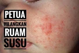 Setiap semburan memberikan kesegaran pada kulit. Mommies Yang Ada Baby Mesti Minyak Kelapa Dara Ibu Kl Facebook