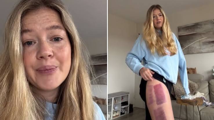 Leah Stewart: Coogee shark attack survivor shares sad recovery update that has left her 'devastated' | The Nightly