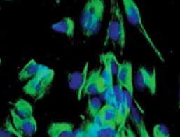 Global cancer deaths are rising: Testicular Cancer Rates Are On The Rise In Young Hispanic Americans Ecancer